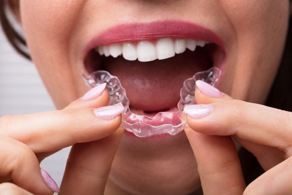 Tips to Stop Teeth Grinding